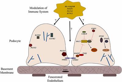 Genetics of Childhood Steroid Sensitive Nephrotic Syndrome: An Update